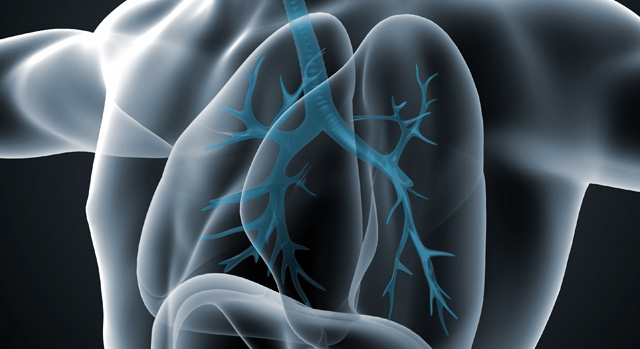 Instituto pulmonar