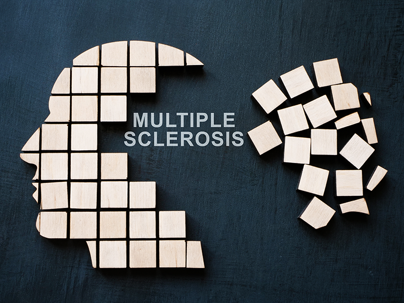 multiple sclerosis